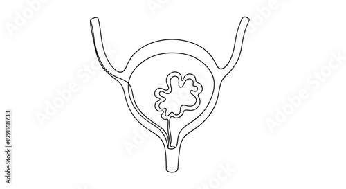 Continuous line art illustration of a human bladder with a tumor, representing medical conditions and internal anatomy with a minimalist aesthetic