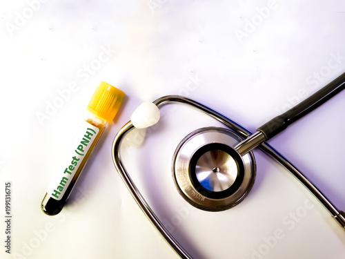 Bilde på lerret Blood sample for Nipah virus and Ham test conceotional image.