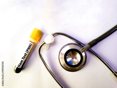 Foto Blood sample for Nipah virus and Ham test conceotional image.