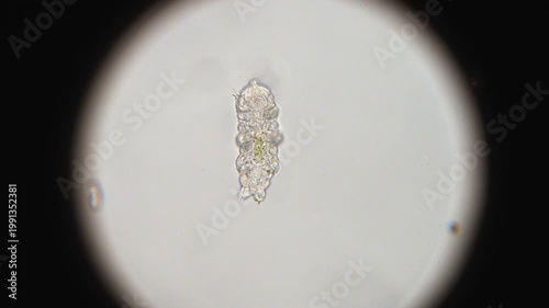Backlit Microscopic Look at a Tardigrade (Water Bear)