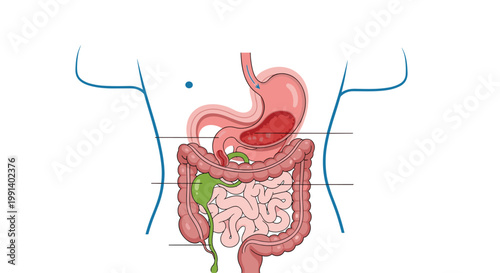 Detailed medical diagram of the human digestive system showing the stomach, intestines, and liver inside a body outline.