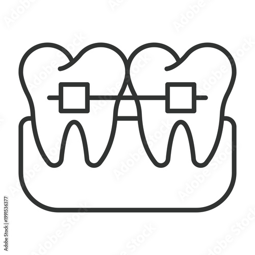 Dental braces treatment, icon in line design. dental, braces, orthodontics, teeth, correction, alignment, dentist on white background vector. dental braces treatment editable stroke icon
