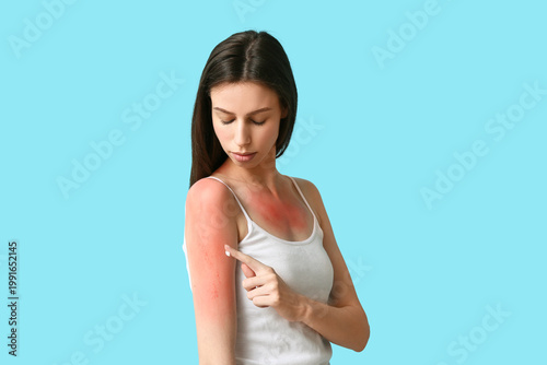Allergic young woman with r...
