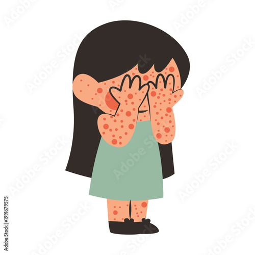 Child with Measles Rash, Covering Face, Healthcare Concept