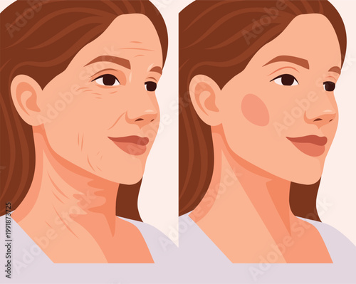 Vector woman's face before and after skincare and rejuvenation procedures. Signs aging include wrinkles, sagging skin, and smooth, rejuvenated skin. For cosmetic, dermatological, anti-aging treatments