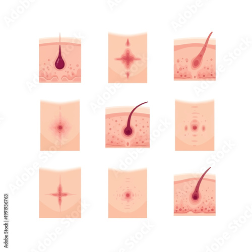 Detailed diagrams illustrating various skin conditions and hair follicle issues.