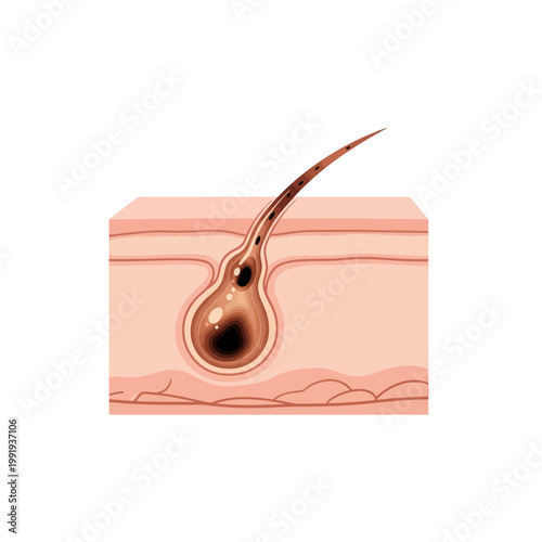 Detailed illustration of human skin cross-section showing a single hair follicle and its root structure.