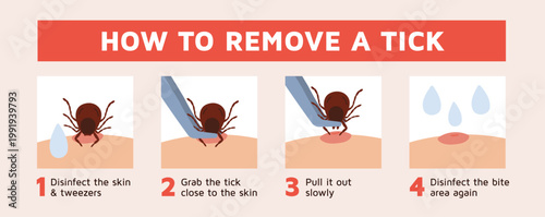 Removing tick. Step by step instructions for removing stuck insect, detection parasite, peddler of serious diseases, medical infographic poster, garish vector cartoon isolated concept