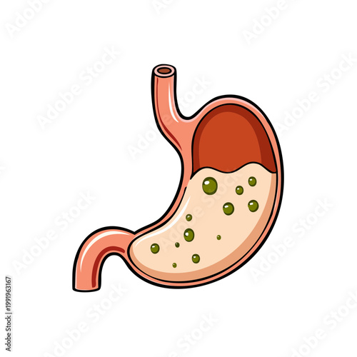 Cartoon illustration of a human stomach showing digestive fluid and contents