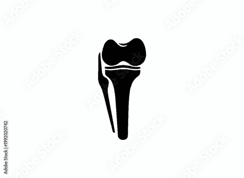 Human Knee Joint Illustration 