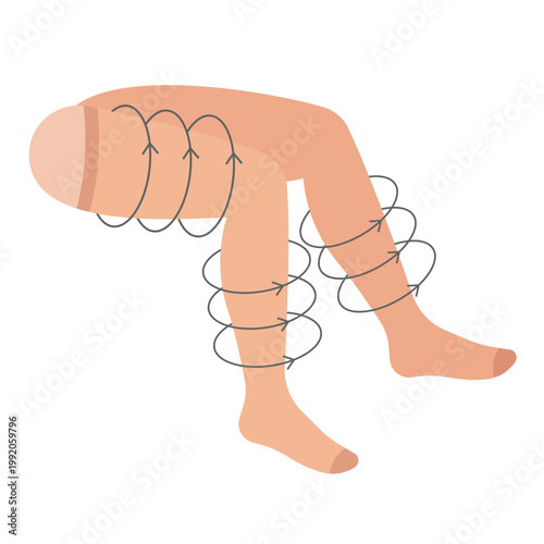 Compression stocking. Socks on the leg with round arrows. Highly specialized medicine