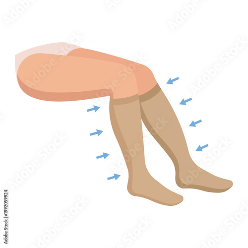 Women's Knee-high compression stockings. Lymphedema. Varicose veins. Highly specialized medicine