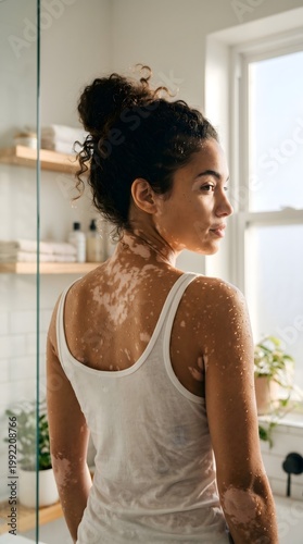 A person with vitiligo looks out a bathroom window