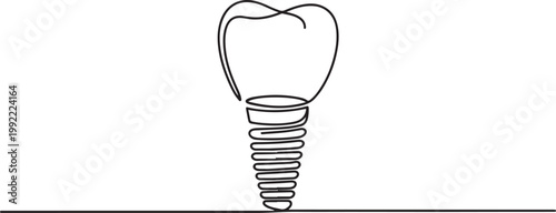 One continuous line illustration of a dental implant, isolated on white background.one line drawing vector illustration