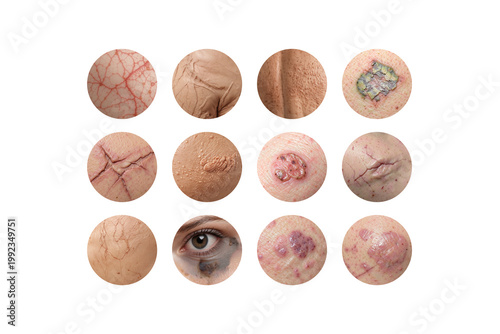 Common skin problems and dermatological conditions set, ai generated. Close up various skin irritation with acne, wrinkles, scars and dermatology disorder. Medical and skincare concept, isolated.