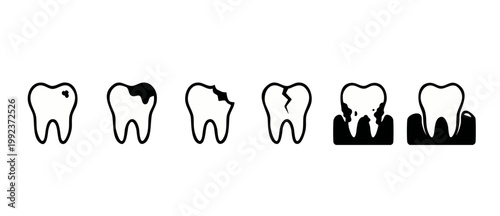 Tooth Decay Stages Icon Set, Dental Caries Progression Infographic for Oral Health Education and Clinic Treatment Planning Showing Cavities, Cracks, Gingivitis, and Healthy Periodontal Condition Black