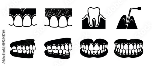 Dental Teeth Icons Set for Dentistry and Oral Health Care, Periodontal Disease Treatment and Orthodontics Symbols, Flat Black Graphic Elements for Medical Clinic Website and Tooth Anatomy Infographics