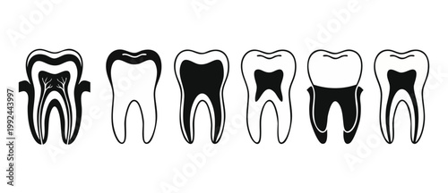 Tooth Decay Stages Icon Set Dental Health Vector Illustration Showing Cavity Progression and Root Canal Treatment for Oral Hygiene Education and Dentist Office Clinic Poster Design Infographic Element