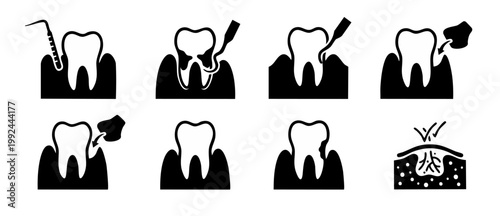 Dental Treatment Process Icons Set Showing Tooth Decay Filling Procedure, Periodontal Care, Root Canal Therapy, Gum Cleaning and Restoration Steps for Orthodontic Clinic Infographics and Patient Educa