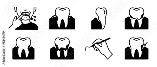 Dental Gum Disease Periodontitis Icon Set, Tooth Decay and Gingivitis Symptoms, Dental Health Oral Hygiene Care Vector Symbols for Dentist Clinic Medical Infographics and Patient Education Graphic Des
