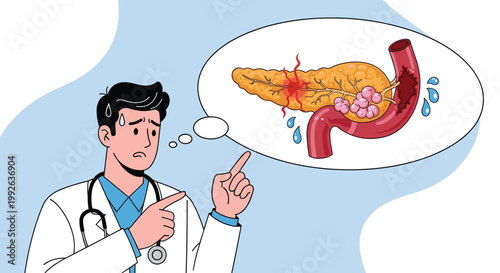 Male doctor in a lab coat pointing towards an illustration of a diseased pancreas with tumors and inflammation.