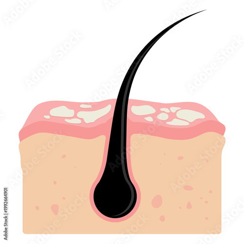 Dandruff on the scalp illustration cartoon cute