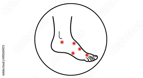 Foot pain illustration with red dots indicating painful spots on the sole and toes.