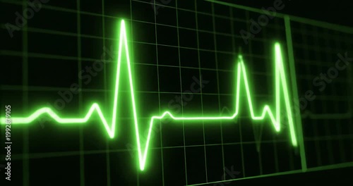 Green heartbeat line displayed on a digital monitor, illustrating vital signs in a medical setting
