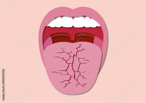 Dry mouth, conceptual illustration