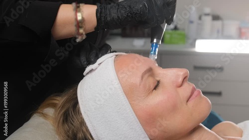 Cosmetologist performing a professional microneedling treatment on a mature woman's forehead