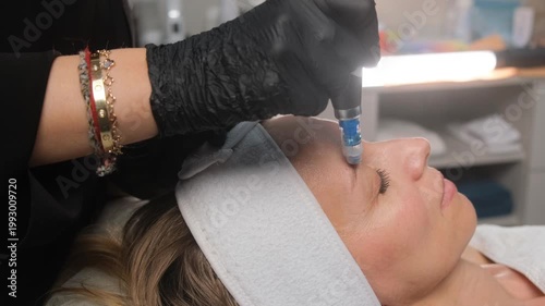 Beautician performs a microneedling anti-aging procedure on a woman's face at a beauty clinic
