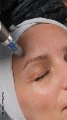 Cosmetologist performing a fractional mesotherapy procedure for a client in a modern beauty salon