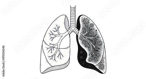 Diseased lung compared to healthy lung with viruses