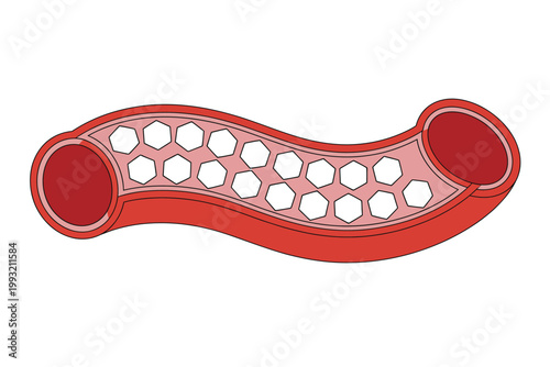 Diabetes disease glucose in blood vessels medical illustration for high blood sugar condition insulin imbalance and health concept