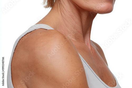 Aging female neck and shoulder with visible skin laxity and slight underarm sagging, natural skin texture and wrinkles conveying soft emotion and clinical cosmetic context