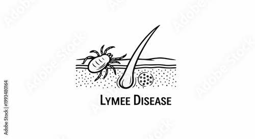 Illustration of a tick and hair follicle on skin, symbolizing disease
