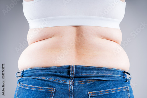 Schilderij op canvas Overweight woman in tight jeans showing love handles and back fat folds, weight