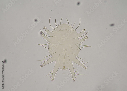 Obraz na plátně soil microorganisms under a microscope including amoeba, flagellates, nematodes,