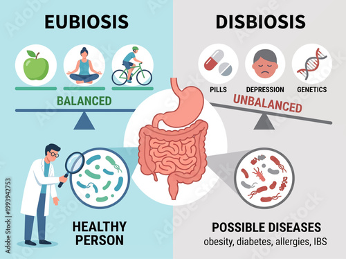 Vector illustration of eubiosis vs dysbiosis comparison infographic of gut microbiome health