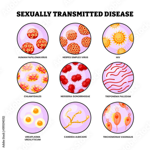 Different types of Sexually transmitted disease infection set collection. Labeled human papillomavirus, herpes simplex virus, hiv, chlamydiales, neisseria, treponema, ureaplasma, candida, trichomonas.
