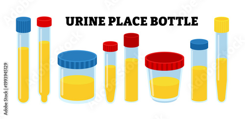 Set of urine place container set collection. medical specimen bottles and tubes collection, laboratory test containers with yellow liquid, healthcare diagnostic equipment, vector illustration