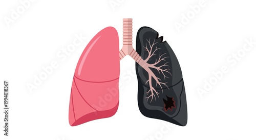 World No-Tobacco Day Healthy Lungs vs. Lungs Damaged by Smoking - A stark visual representation of the impact of tobacco on respiratory health