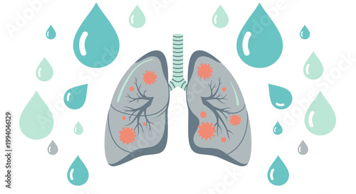 Infected lungs with virus particles and raindrops illustration for health awareness campaign
