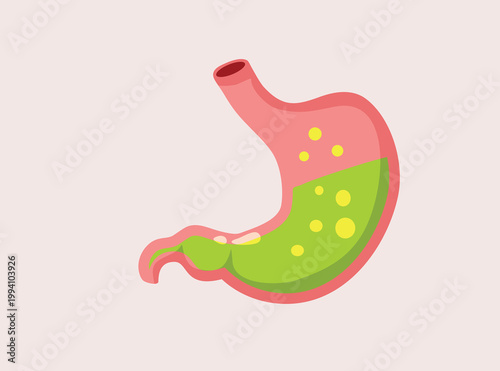 Stomach Suffering from Gastric Reflux Vector Illustration. Sick organ having discomfort presenting  dyspepsia symptoms 