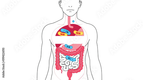 Outline of a human torso reveals internal organs like lungs, stomach, and intestines with bacteria inside, symbolizing infection, gut health, and human microbiome.