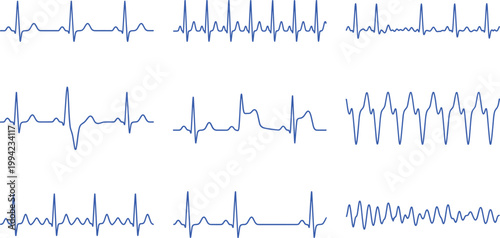 ECG heartbeat waveform set, medical cardiogram pulse monitor collection, electrocardiogram line vector healthcare design pack icons