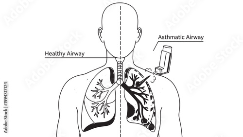 Diagram of Human Respiratory System Showing Airways and Lungs.