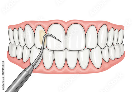 A dentist examines a tooth with a dental tool in a mouth.