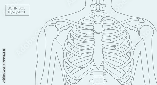 Medical illustration of a human skeletal structure showing the rib cage