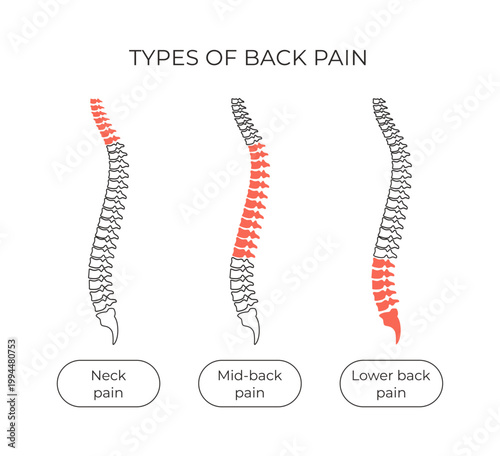 Vector types of back pain in cervical spine, thoracic spine and lumbar spine. Different kinds of backache: neck pain, mid back pain and lower back pain. Line illustration of spine problems